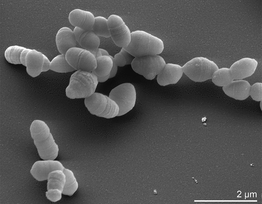 Kolloidal Gümüş ve Streptococcus Aureus